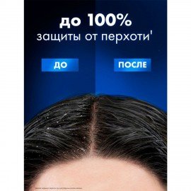 Шампунь против перхоти 400 мл, CLEAR MEN "Ледяная свежесть"